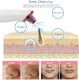 Blackhead Remover Pore Vacuum Cleaner Daweir Upgraded Blackhead Removal Kit Electric USB Rechargeable Acne Comedone Whitehead Extractor with 5 Probes and Facial Pore Cleaner Suction for Women & Men