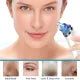Derma Suction Blackhead Removal Machine 5 in 1 Black Head Remover Machine, pimple acne remover, dust remover, dirt remover, Pimple Popper Tool, Whitehead Acne remover, deep face clean blackhead remover