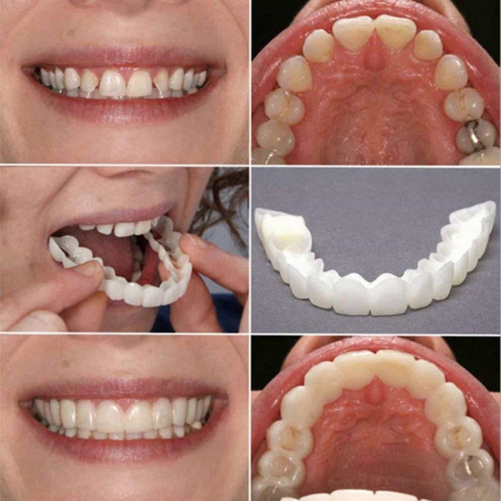 Silicone Imitation Braces Teeth Decoration Kits Environmentally Friendly And Safe Silicone Artificial Braces Snapon SmileSilicone Imitation Braces Teeth Decoration Kits Environmentally Friendly And Safe Silicone Artificial Braces Snapon Smile